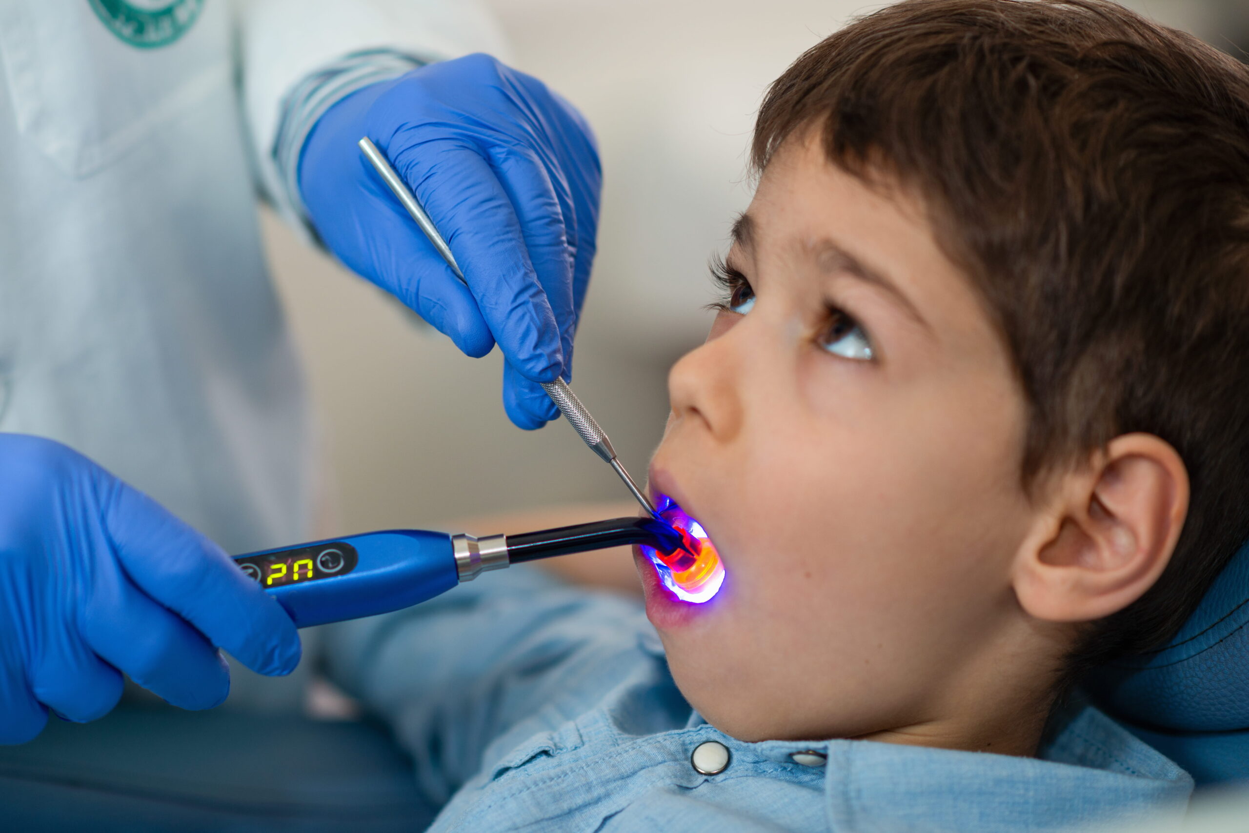 tooth sensitivity after a filling